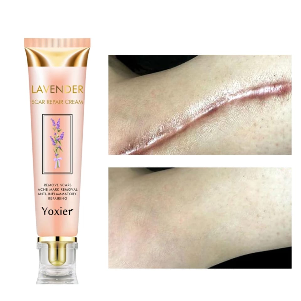 Scar Remover